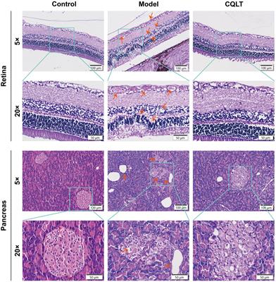 Metabolomics combined with intestinal microbiota reveals the mechanism of compound Qilian tablets against diabetic retinopathy